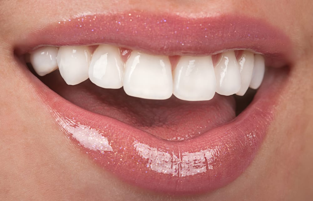 COSMETIC DENTISTRY